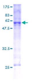 SDS-PAGE (HMOX1-4884H).jpg
